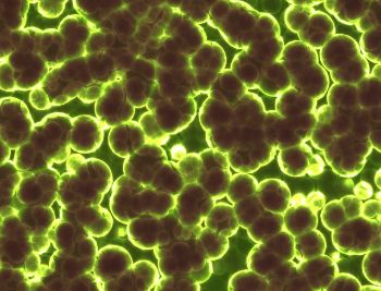 BACTERIA_MICROBES_1.jpg