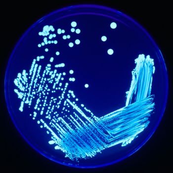 Legionella Plate - Image credit CDC - James Gathany